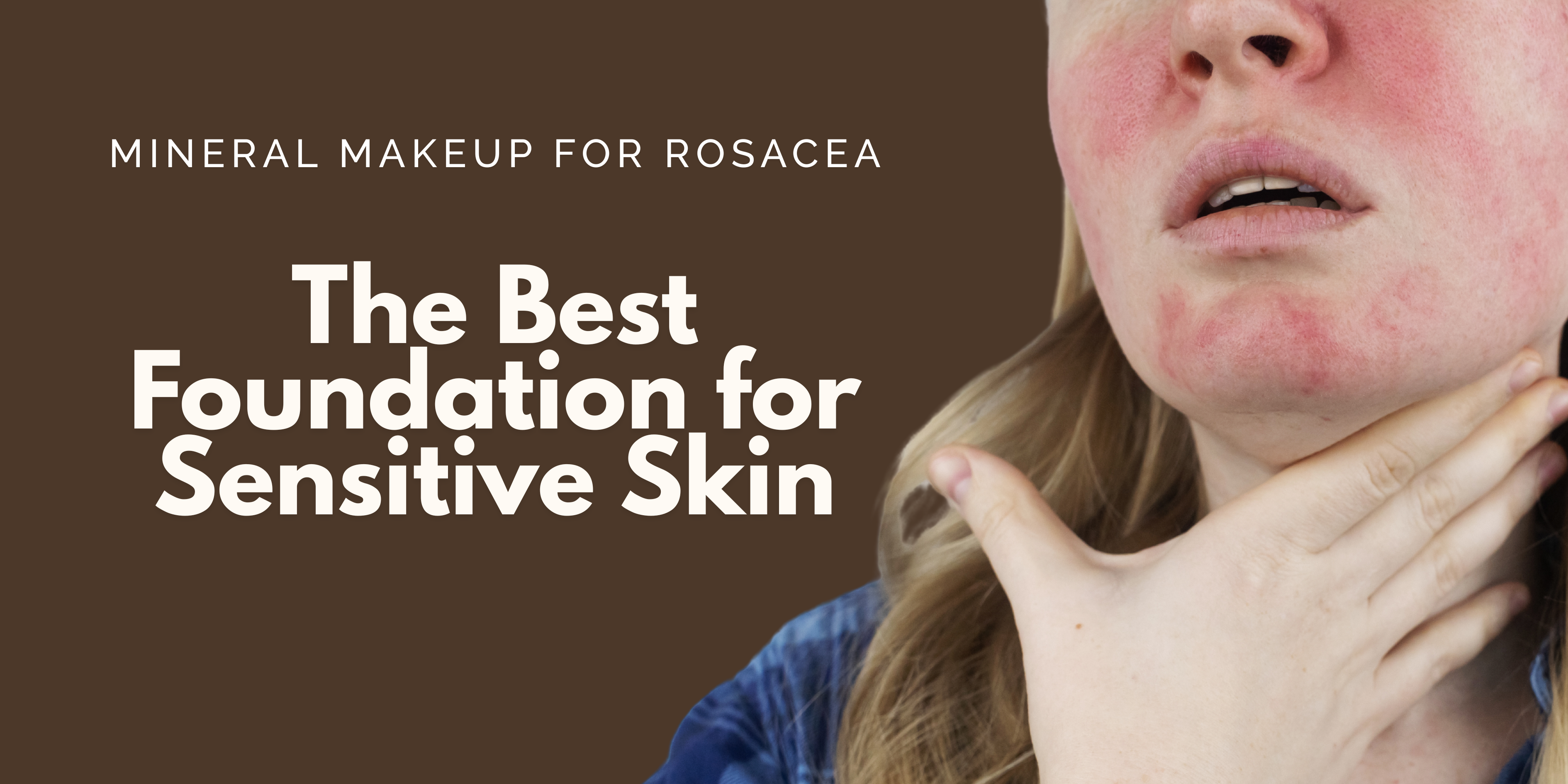 Mineral Makeup for Rosacea: The Best Foundation for Sensitive Skin